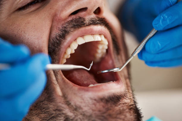 Best Root Canal Treatment  in Oyster Creek, TX